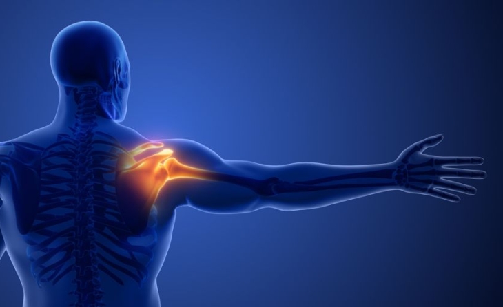 Τενοντοπάθεια υπερακάνθιου μυός